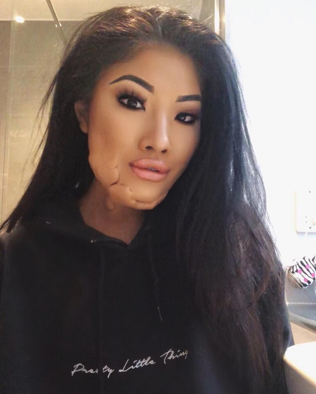 Sophie Lee adalah seorang model. penari fire breather, juga selebgram yang wajahnya terbakar. Wanita tersebut mengalami insiden saat pertunjukkan fire dancing yang meninggalkan luka permanen di wajah cantiknya. Foto: Instagram @sophirelee