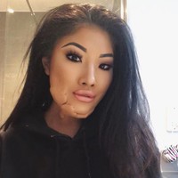 Sophie Lee adalah seorang model. penari fire breather, juga selebgram yang wajahnya terbakar. Wanita tersebut mengalami insiden saat pertunjukkan fire dancing yang meninggalkan luka permanen di wajah cantiknya. Foto: Instagram @sophirelee