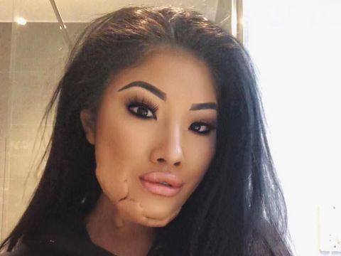 Selebgram Korban Luka Bakar Diminta Promosi Sampo dengan Membakar Rambut