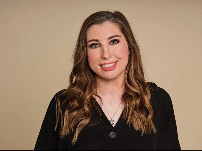 Brand kecantikan Avon merilis kampanye True Nudes yang menampilkan kecantikan berbeda setiap wanita. Salah satu wanita yang menjadi modelnya adalah Catrin Pugh. Foto: Dok. Avon