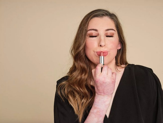 Kerjasama Catrin dengan Avon membuatnya menjadi model kecantikan pertama dengan luka bakar untuk brand berbasis di London, Inggris tersebut. Avon pun menjadi brand kecantikan ternama yang bekerjasama dengan Changing Faces, badan amal yang melawan stigma tentang perbedaan fisik pada seseorang. Foto: Dok. Avon