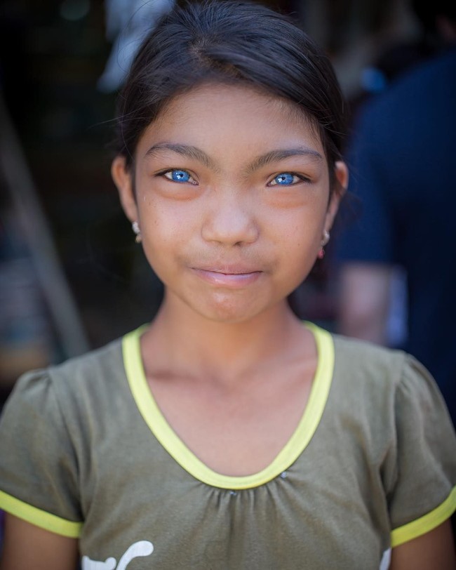 Beberapa orang memiliki warna mata yang berbeda karena kelainan genetis langka. Gadis asal Bali yang dipotret fotografer Justin Rayboun ini pun mendapatkannya karena sindrom Waardenburg. Kondisi tersebut membuat warna mata gadis tersebut menjadi biru dan membuatnya mencuri atensi. Instagram: @justinrayboun