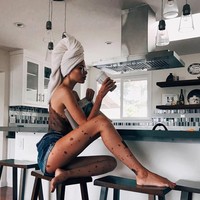 Wanita 25 tahun itu tak ingin terus-menerus hidup dalam ketakutan karena terpengaruh dengan ejekan yang ia terima. Kini Yulianna bangkit dari keterpurukannya dan membawa misi untuk memperkenalkan tanda lahir yang bisa dialami oleh siapa saja.  Foto: Instagram (@yulianna.yussef)