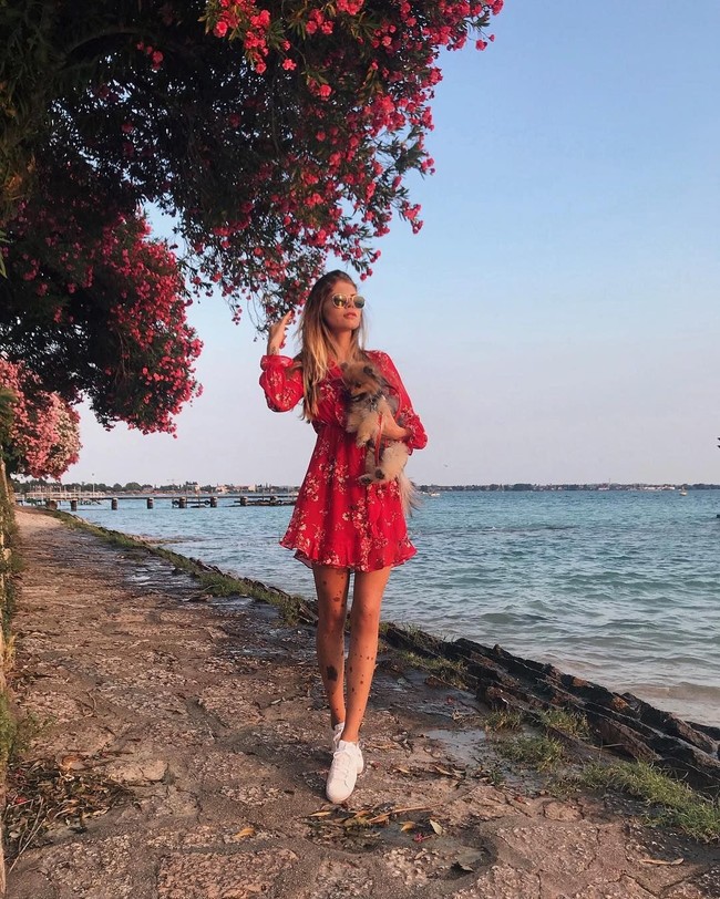 Misinya adalah ia ingin memperkenalkan kondisi CMN. Sehingga tak ada anak-anak atau remaja lain yang menjadi korban bully seperti dirinya dulu.  Foto: Instagram (@yulianna.yussef)