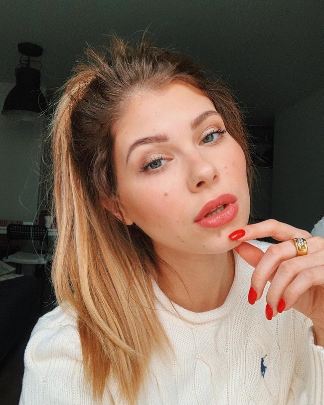 Selebgram asal Polandia, Yulianna Yussef hidup dengan penindasan yang tak henti-hentinya. Punya tanda lahir yang hampir di seluruh punggung, perut hingga kakinya membuat Yulianna disamakan dengan monyet hingga sapi kotor.  Foto: Instagram (@yulianna.yussef)