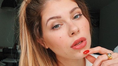 Foto: Selebgram Cantik yang Diejek Sapi Kotor karena Punya Tanda Lahir
