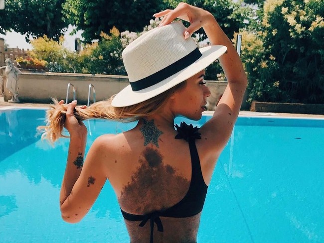 Kini di Instagramnya, Yulianna dengan percaya diri menunjukkan tanda lahir warna kehitaman di area tubuhnya.  Foto: dok. Instagram (@yulianna.yussef)