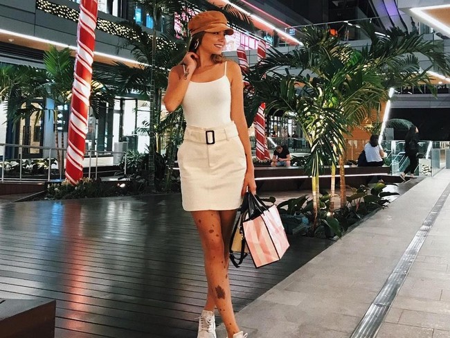 Setelah tahunan ia terus diejek, Yuliana memutuskan untuk tidak terpengaruh lagi dengan omongan orang lain. Aku dulu disebut anjing dalmatian, jerapah, sapi kotor, orang akan berpikir seperti itu jika berbicara padaku, ucapnya.  Foto: Instagram (@yulianna.yussef)