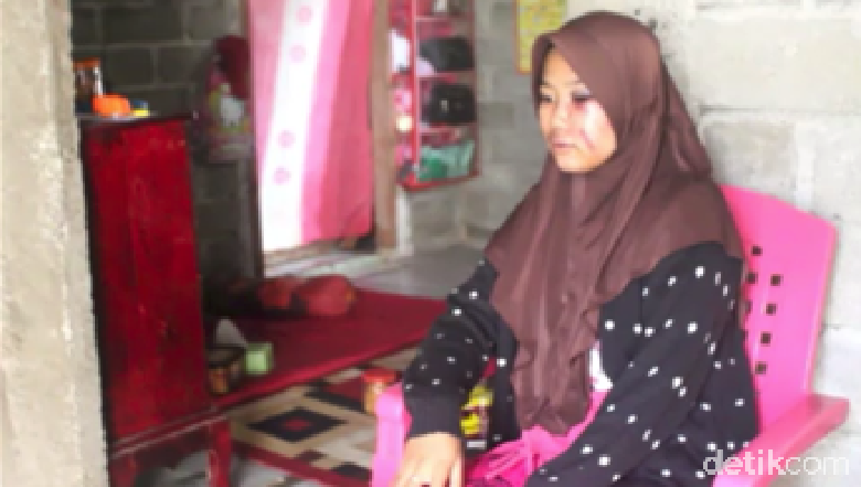 Dianiaya OTK, Wanita Muda di Sulbar Babak Belur dan Nyaris Buta Dianiaya OTK, Wanita Muda di Sulbar Babak Belur dan Nyaris Buta