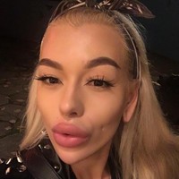 Kegilaannya dengan operasi plastik sudah dimulai sejak lima tahun lalu. Prosedur kecantikan yang pertama kali ia lakukan adalah filler bibir. Yang semakin lama, bibirnya dibuat semakin besar dan tebal.  Foto: Instagram (@elena_rosso)