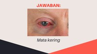 Terlalu banyak menatap layar biru baik komputer, televisi, maupun handphone bisa membuat mata kering dan berisiko iritasi. Kamu bisa menggunakan tetes mata untuk menghindarinya. Ada yang bisa jawab semua dengan benar? Tulis yuk di kolom komentar! (Foto: detikHealth)