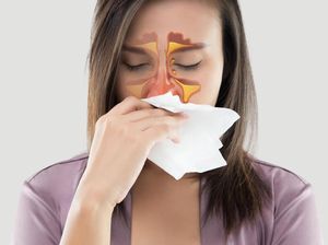 Gejala, Pencegahan, dan Cara Pengobatan Sinusitis