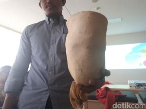 Berbagai Pertimbangan Sebelum Pasang Kaki Prostetik