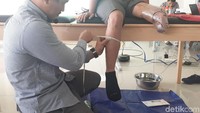 Bukan hanya kaki yang diamputasi, kaki lainnya pun diukur agar pembuatan kaki prostetik sesuai dengan kaki lainnya. Foto: Widiya Wiyanti/detikHealth 