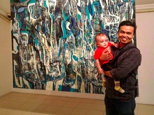 Kondisi Terkini Zulfirman, Seniman Indonesia Korban Penembakan New Zealand