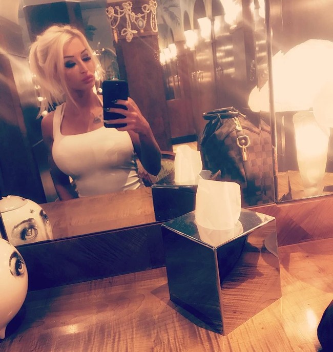 Hampir semua operasi plastiknya dibiayi oleh mantan kekasihnya, yang juga punya obsesi gila seperti Paulina. Biaya yang dikeluarkan untuk operasi plastik hingga 50 ribu poundsterling atau sekitar Rp 946 juta.  Foto: dok. Instagram (@paulinajcandy)