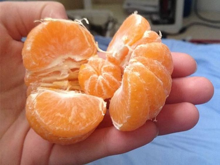 Telur hingga Pepaya, 10 Makanan Ini Bisa Punya Anak di Dalamnya