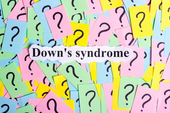 ilustrasi down syndrome