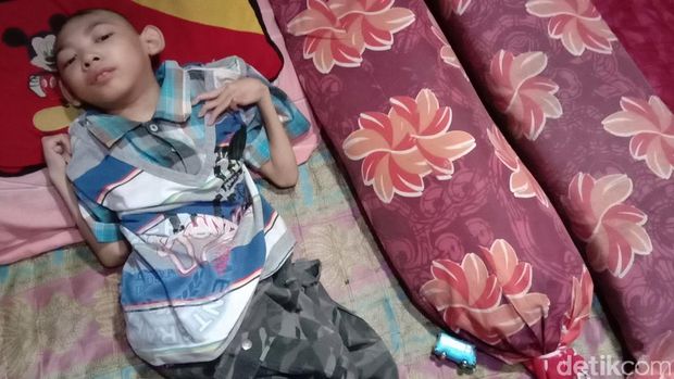 Kisah Rizky, Pengidap Pengecilan Otak yang Divonis Tak Bisa Sembuh 