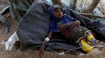 Potret Memilukan Kondisi Anak-anak Korban Perang di Yaman