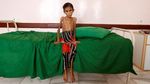 Potret Memilukan Kondisi Anak-anak Korban Perang di Yaman