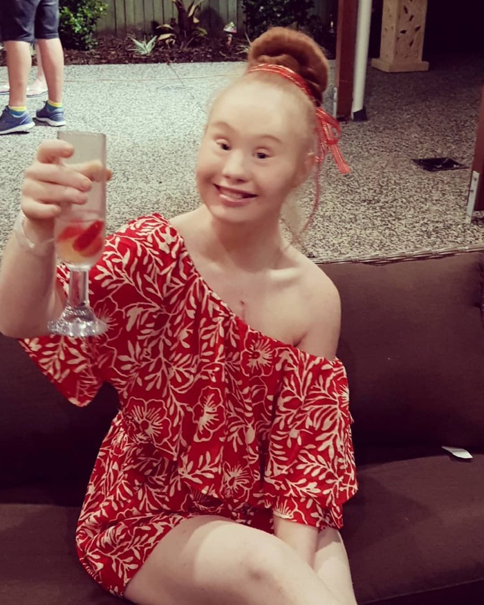 Cantiknya Madeline Stuart Model Down Syndrome Yang Suka Wisata Kuliner