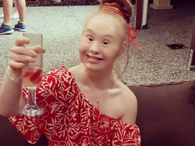 Cantiknya Madeline Stuart, Model Down Syndrome yang Suka Wisata Kuliner