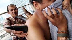 Selain Tanduk, Berbagai Media Ini Juga Bisa Dipakai untuk Bekam Selain Tanduk, Berbagai Media Ini Juga Bisa Dipakai untuk Bekam