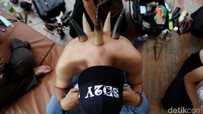 Beda dari yang lain, bekam ini menggunakan tanduk sebagai medianya. (Foto: Muhammad Ridho) Beda dari yang lain, bekam ini menggunakan tanduk sebagai medianya. (Foto: Muhammad Ridho)