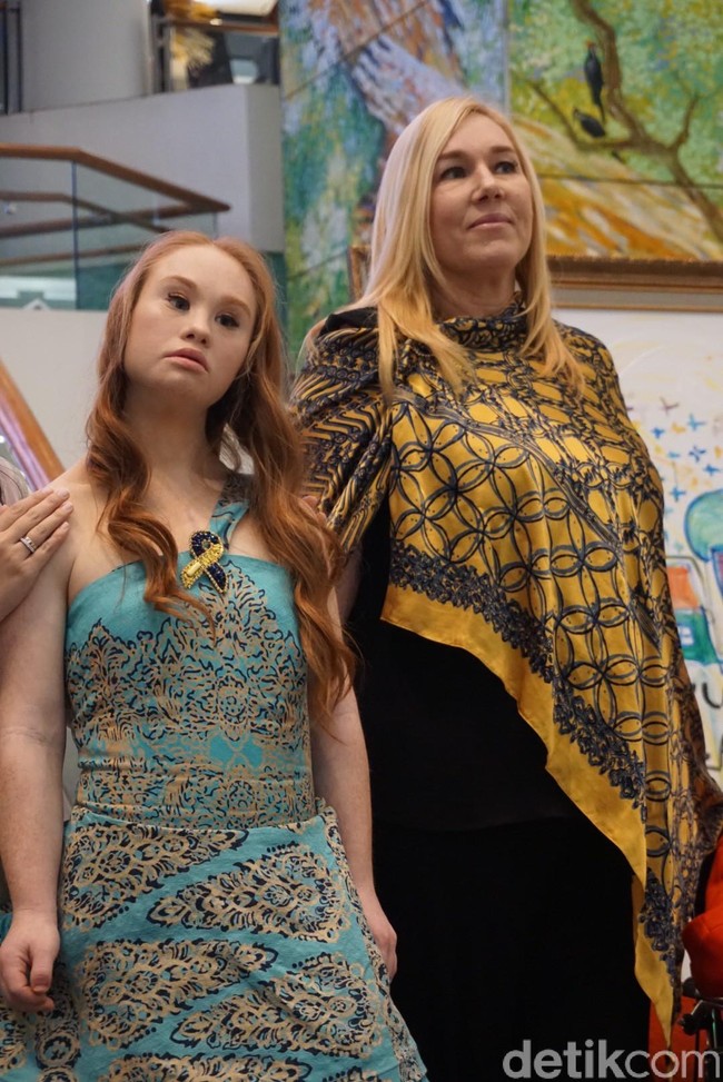 CEO Alleira Lisa Mihardja mengaku sangat terinspirasi oleh sosok Madeline, yang membuat ia ingin mengajaknya bekerjasama dengan Alleira. 2017 bertemu Madeline, we just fell in love. We got inspired by her. Madeline dengan keterbatasannya bisa jadi first professional model. Kita sudah ajak dia dari tahun lalu, tapi dia sangat sibuk, dan baru bisa saat ini, ujar Lisa. Foto: Alissa Safiera/Wolipop