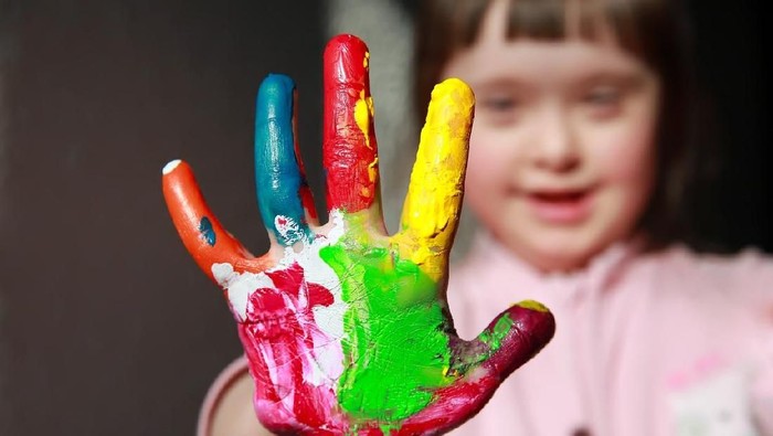 Anak down syndrome lebih berisiko terkena penyakit jantung bawaan. (Foto: iStock) Anak down syndrome lebih berisiko terkena penyakit jantung bawaan. (Foto: iStock)