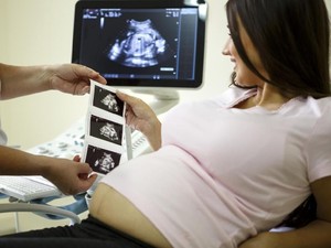 Perkembangan Janin yang Normal di Trimester 1, 2, dan 3