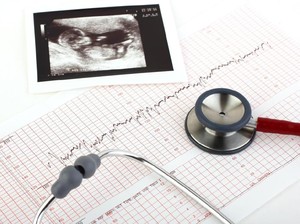 Kata Dokter Soal Kandungan Rumput Fatimah yang Viral Bikin Janin Meninggal