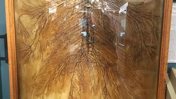 Ini adalah hasil bedah jenasah yang memperlihatkan sistem saraf manusia. Disusun oleh dua mahasiswa kedokteran pada tahun 1925 di Missouri dan dipajang di museum Osteopathic Medicine di A.T. Still University (ATSU). Foto: boredpanda