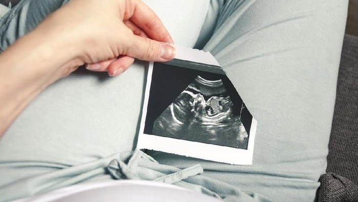 Pasutri dari Inggris kaget foto USG bayi mereka mirip alien. (Foto ilustrasi: iStock) Pasutri dari Inggris kaget foto USG bayi mereka mirip alien. (Foto ilustrasi: iStock)