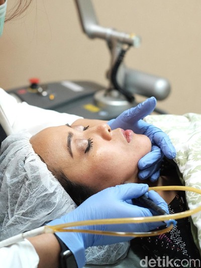 Perawatan laser wajah. Foto: Silmia Putri/Wolipop Perawatan laser wajah. Foto: Silmia Putri/Wolipop