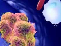 Video Kemenkes soal AI untuk Terapi Kanker: Bukan Menggantikan Diagnosis