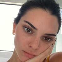 Jika kamu menginginkan cara praktis dengan hasil yang lebih cepat, kamu mungkin dapat mencoba tips Kendall Jenner dalam mengatasi masalah jerawatnya. Saudara dari Kylie Jenner ini melakukan tindakan laser. Tindakan laser yang dilakukannya bernama Laser Genesis. Cara ini ampuh untuk menghilangkan noda kemerahan pada kulit dan menstimulasi produksi kolagen. Namun sayangnya tindakan ini cukup menguras kantong. Jadi, siapkan dana dulu ya sebelum memutuskan melakukan tindakan ini. Foto: Getty Images