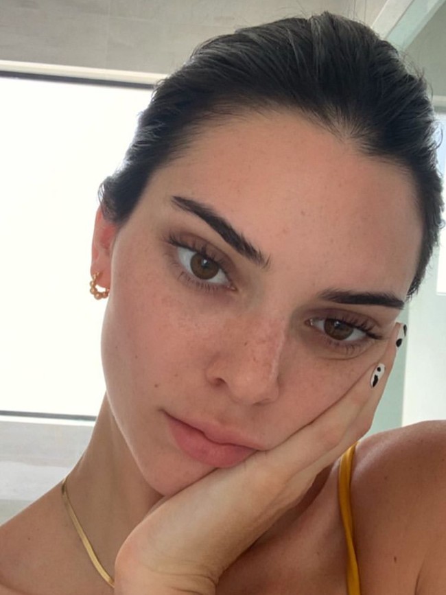 Jika kamu menginginkan cara praktis dengan hasil yang lebih cepat, kamu mungkin dapat mencoba tips Kendall Jenner dalam mengatasi masalah jerawatnya. Saudara dari Kylie Jenner ini melakukan tindakan laser. Tindakan laser yang dilakukannya bernama Laser Genesis. Cara ini ampuh untuk menghilangkan noda kemerahan pada kulit dan menstimulasi produksi kolagen. Namun sayangnya tindakan ini cukup menguras kantong. Jadi, siapkan dana dulu ya sebelum memutuskan melakukan tindakan ini. Foto: Getty Images