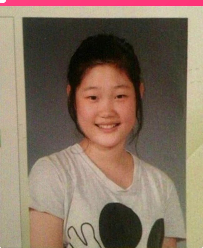 Sejak mulai debut sebagai anggota girl group, banyak netizen sudah curiga jika Chaeyeon telah melakukan beberapa perbaikan di wajahnya. Ia pun mengaku pernah menjalani operasi hidung ketika masih duduk di bangku sekolah. Namun untuk kelopak mata ganda, mantan personel IOI tersebut mengaku mendapatkannya secara alami. Foto: Instagram @j_chaeyeoni