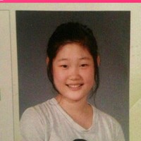 Sejak mulai debut sebagai anggota girl group, banyak netizen sudah curiga jika Chaeyeon telah melakukan beberapa perbaikan di wajahnya. Ia pun mengaku pernah menjalani operasi hidung ketika masih duduk di bangku sekolah. Namun untuk kelopak mata ganda, mantan personel IOI tersebut mengaku mendapatkannya secara alami. Foto: Instagram @j_chaeyeoni