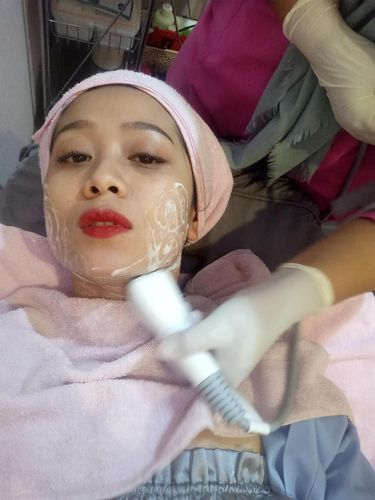 Review: Mengecilkan Perut di Beautylogica, Ukurang Pinggang Berkurang 4 Cm 