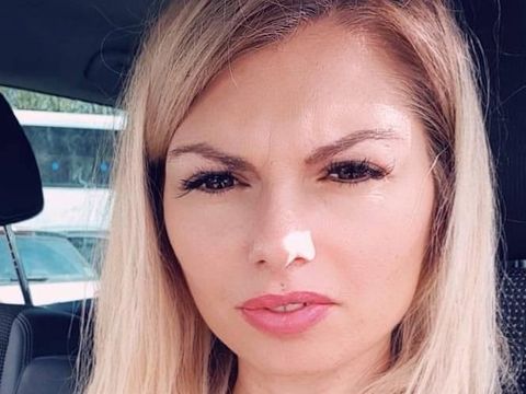 Jalani 2 Oplas Sekaligus, Wanita Ini Tewas Karena Penggumpalan Darah