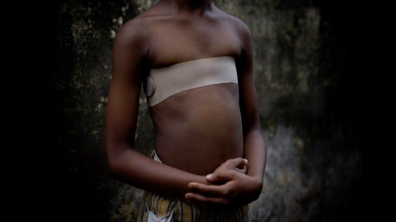 Menyetrika Payudara, Praktik dari Afrika yang Masih Terjadi di Inggris Menyetrika Payudara, Praktik dari Afrika yang Masih Terjadi di Inggris