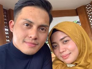 Demi Suami, Muzdalifah Permak Wajah dengan Suntik Botox