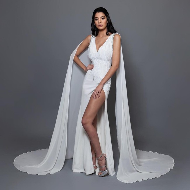 Operasi plastik itu pun dilakukan sebagai persiapan untuk mengikuti Miss World 2014. (Foto: Instagram/@barbsantana)