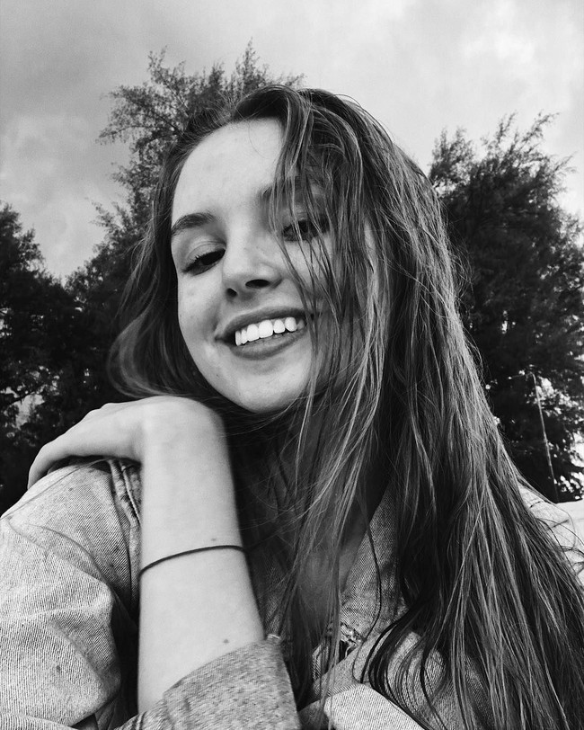 Yang juga disayangkan adalah Alisa tidak memiliki asuransi kesehatan. Karena itu, teman-temannya harus menanggung biaya rumah sakit sekitar £17,700 (Rp 328 jutaan) per malam selama ia dirawat. Foto: Instagram @miitrova