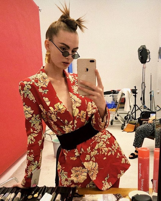 Wanita asal Rusia ini awalnya didiagnosa sakit cacar air oleh dokter di sana. Tapi belakangan Alisa diketahui menderita penyakit yang lebih parah yakni meningitis. Dikatakan jika itu terjadi setelah ia bekerja di runway selama tujuh bulan tanpa henti. Foto: Instagram @miitrova