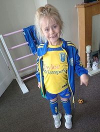 Kena Sindrom Rambut Langka, Gadis Ini Jadi Mirip Chucky dan Boneka Troll