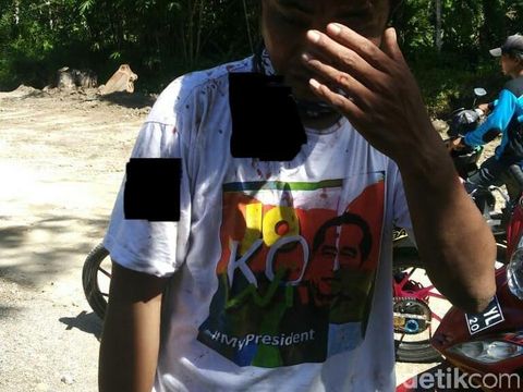 BPN Dukung Polisi Usut Pendukung Prabowo yang Keroyok Warga Berkaus Jokowi